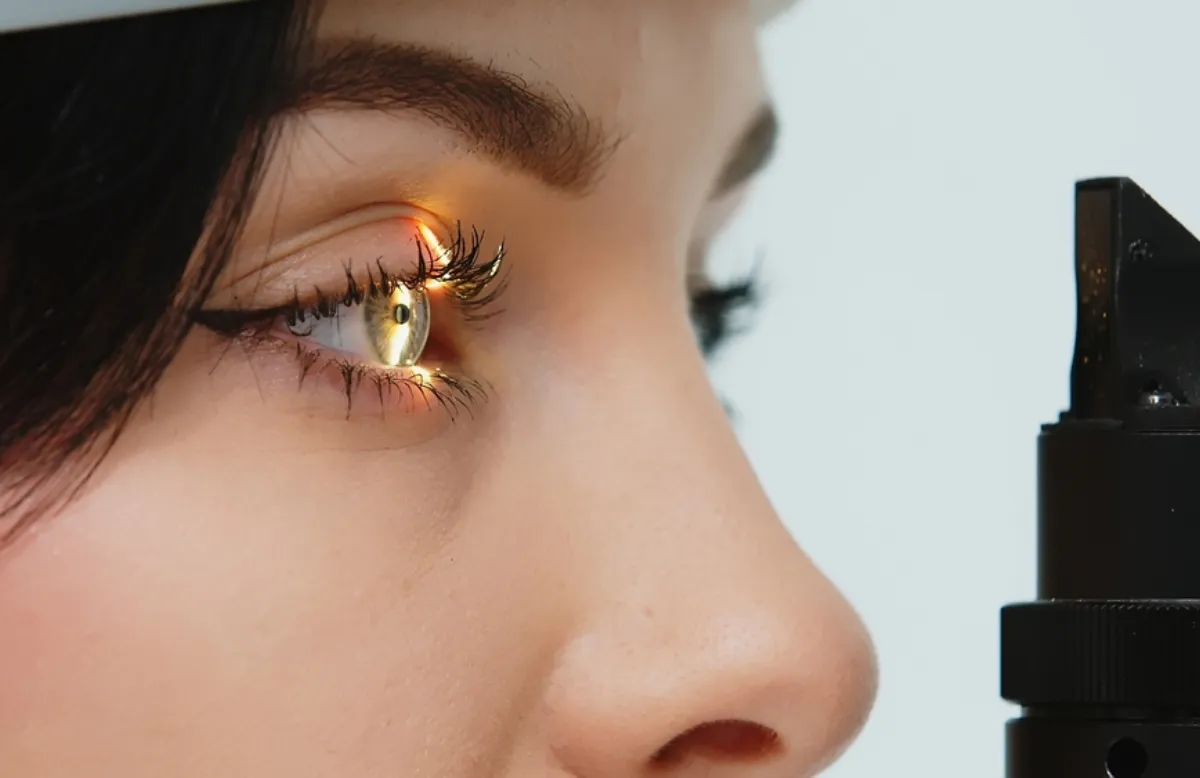 Refractive Surgery
